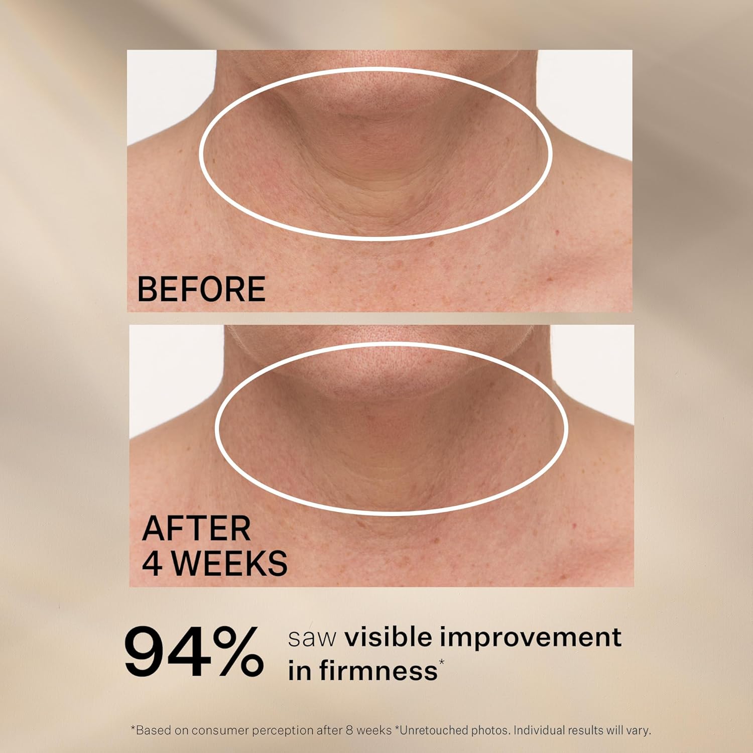 StriVectin TL Advanced Tightening Neck Cream PLUS w/ Alpha-3 Peptide, 30 ml / 1 FL OZ